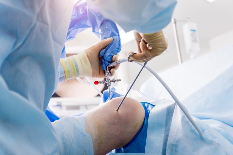 Reconstrucción ligamentaria