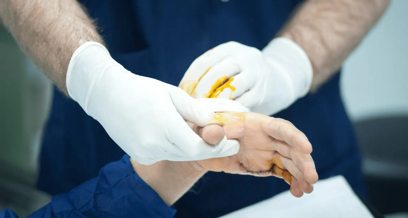 ¿Cómo tratar el dolor de rodilla en Monterrey de forma efectiva?